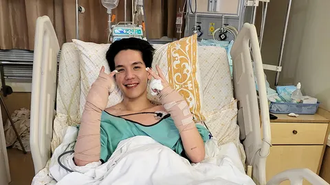 “มิว” ตกใจไฟลวกมือจะรีบรักษาตัวให้หายดี ติดตลก “ลาพักร้อน” ขอบคุณทุกความห่วงใย