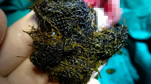 แมวถ่ายไม่ออก กินอะไรไม่ได้ร่วมเดือน หมอผ่าตัดด่วน เจอมุ้งลวดอุดตันในกระเพาะ