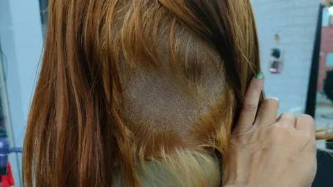 อุทาหรณ์ สาวฟอกทำสีเอง สุดท้ายเสียหายหนักมาก ผมขาดจนเห็นหนังหัว