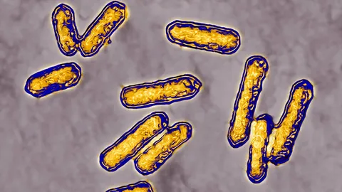 CDC เผย เชื้อลิสทีเรียระบาดใน 6 รัฐ ตายแล้ว 1 ศพ ป่วยอีกนับสิบ