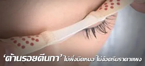 'ต้านรอยตีนกา' ไม่พึ่งมีดหมอ ไม่ง้อครีมราคาแพง