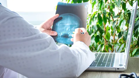 รู้จัก “มะเร็งโคนลิ้น” สาเหตุและอาการเป็นอย่างไร รักษาได้หรือไม่ 