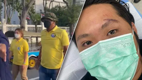 “อานนท์” อ้างทำร้าย “สายน้ำ ทะลุวัง” ปกป้องมวลชน แต่กลับถูกพวกเดียวกันด่ายับ