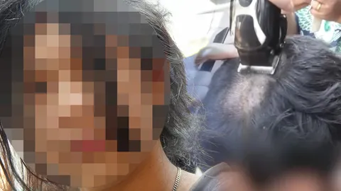 พฤติกรรมแปลกไม่อาบน้ำ-ตัดผม เหาเต็มหัว เชื่อผีเข้าสิง หรือโรคจิตจากความกลัว