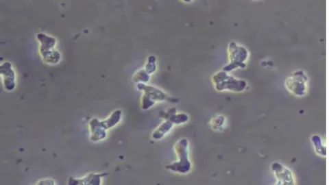 ช็อก เกาหลีใต้พบผู้เสียชีวิตจากเชื้ออะมีบากินสมองรายแรก หลังกลับจากไทย