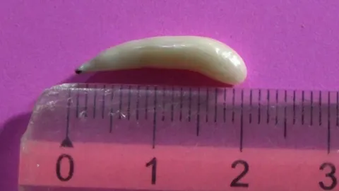 น่าจะใช่! ไข่มุกเม็ดยาว เจอในหอยแมลงภู่ เก็บไว้ 13 ปี มีขนาดใหญ่ขึ้น