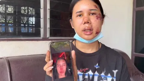 สาวสองสุดช้ำ การ์ดร้านดังรุมยำดั้งหัก กล่าวหาเต้นยั่วยวน ไม่ใส่ กกน.