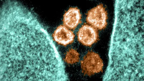 โอมิครอน XBB.1.5 โควิดสายพันธุ์แพร่ไวสุด น่ากังวลแค่ไหน?