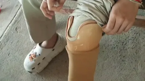 แม่โต้ ไม่ได้ฮุบค่าชดเชยลูกสาวพิการ แต่ลูกอยากได้ จยย. PCX ราคาเป็นแสน