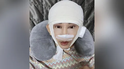 เปิดหน้าล่าสุด พจน์ อานนท์ หลังศัลยกรรมครบ 6 เดือน หล่อมากนึกว่าพระเอกเกาหลี