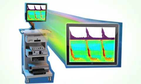 Manometry การตรวจการเคลื่อนไหวทางเดินอาหาร