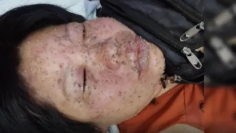 ผึ้งป่าคลั่ง บินหนีไฟไหม้ในอุทยานฯ รุมต่อยยายพิการหวิดดับ (คลิป) 