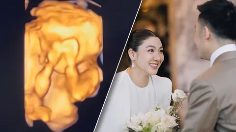 ใบเตย พรพจี ประกาศข่าวดี ตั้งท้องแล้ว โพสต์คลิปอัลตราซาวนด์ของลูกน้อย