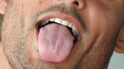 หญิงฝรั่งเศสใจเด็ด กัดลิ้นคนร้ายหื่นส่งเป็นหลักฐานตร.