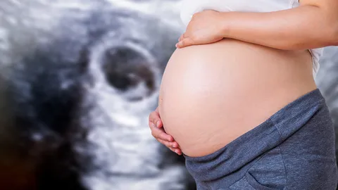 ประเทศไทยตั้งเป้าลดอัตราการผ่าตัดคลอดให้อยู่ในตัวเลขที่เหมาะสม