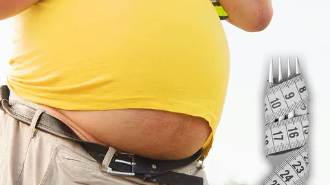 4 มีนาคม "วันอ้วนโลก" กว่า 4 ล้านคน ตายจากภาวะน้ำหนักเกิน