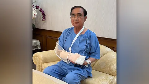 เปิดภาพ “บิ๊กตู่” แอดมิตโรงพยาบาล เข้าเฝือก สวมชุดคนไข้ แพทย์สั่งงดภารกิจเกือบ 7 วัน