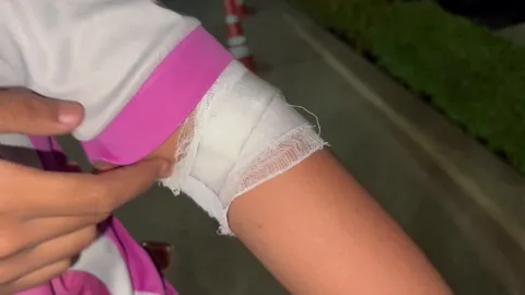 ตร.อึ้ง วัยรุ่นบุรีรัมย์อายุ 12 ทำระเบิดใช้เอง ขว้างใส่อริบาดเจ็บ 