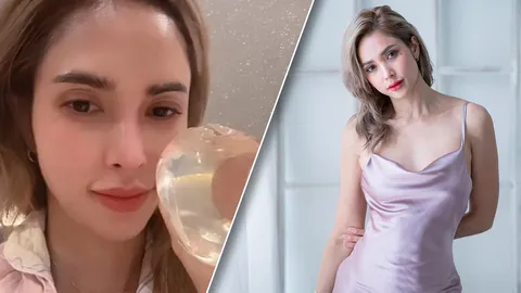 อุ้ม ลักขณา ยังเก็บซิลิโคนหน้าอกที่ผ่าออก อึ้งเมื่อก่อนใส่ไปได้ยังไง