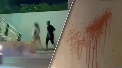 สาววัย 24 เล่าประสบการณ์เตือนภัยโรคจิตเดินตาม ฉีดสเปรย์สีแดงใส่กางเกง