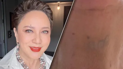 ตุ๊ก ดวงตา โดนสั่งให้ลบรอยสัก สุดงงเส้นเลือดขึ้นมาเป็นตัวเลข คนแห่ซูมชัดมาก