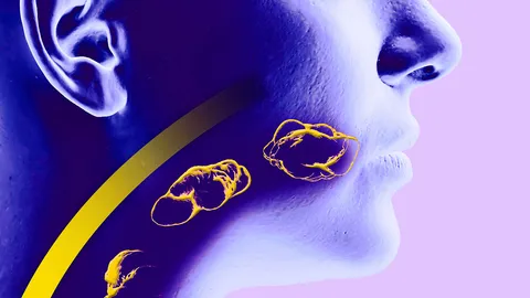 พบมะเร็งช่องปากที่ลิ้นสูงสุดแนะวิธีตรวจเอง