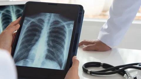 โรคจากรังสี ซีเซียม-137 แตกตัว คุมพื้นที่ PM 2.5