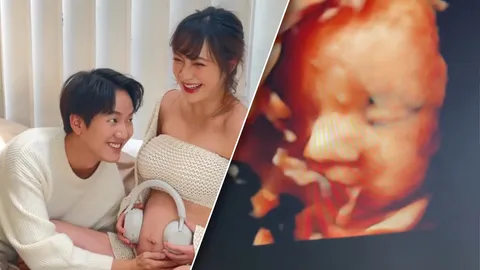 หญิง ธนิจจิญญา ตั้งท้องลูกคนแรก อัลตราซาวนด์เห็นดั้งโด่งมาก (คลิป)