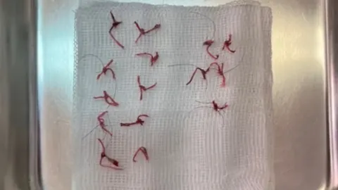 คุณหมอหัวจะปวด เจอคนไข้ "เย็บแผล" ห้ามเลือดให้ตัวเอง ก่อนมารักษา