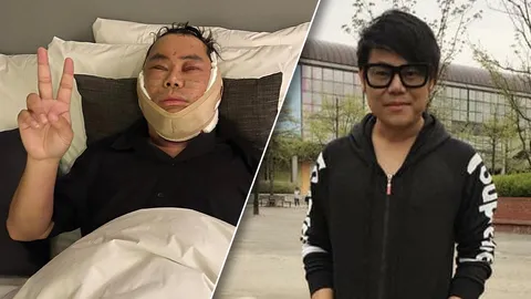 เพชร สหรัตน์ เผยภาพล่าสุด หลังบินไปเกาหลีทำศัลยกรรมหน้าเสริมหล่อ