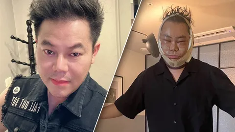 เปิดหน้า เพชร สหรัตน์ ศัลยกรรมครั้งแรก 12 อย่าง จำแทบไม่ได้ โกงอายุไป 15 ปี