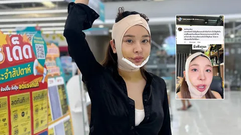 หญิงแย้ นนทพร เจ้าแม่ศัลยกรรม โดนแซะแรง หน้าใหม่ไม่ดูสวยขึ้นเลย 