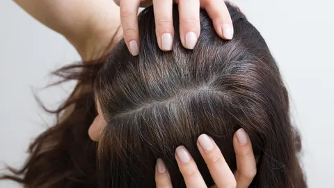 ฝันว่าผมหงอกเต็มหัว หงอกเป็นกระจุก สื่อถึงเรื่องใด ร้ายหรือดี