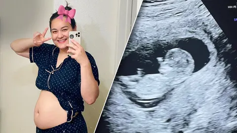 นาตาลี เดวิส เฉลยเพศลูกคนที่ 2 หลังตั้งครรภ์ 3 เดือน ท้องใหญ่เร็วมากแม่