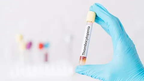 ภาวะเกล็ดเลือดต่ำ เกิดจากอะไร อันตรายหรือไม่