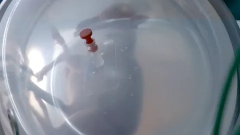 นักวิจัยทำมดลูกเทียมช่วยทารกที่คลอดก่อนกำหนด