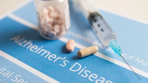 ข่าวดี ยาชะลอโรคอัลไซเมอร์ ตัวพัฒนาอาจได้รับการอนุมัติใช้งานปี 2023 นี้