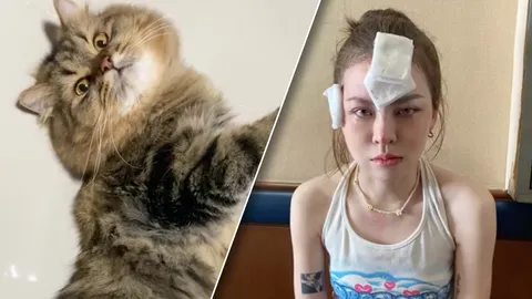 สาวเผยชีวิตทาสแมวฮาร์ดคอร์ มีแผลเต็มหน้า แต่ถอนตัวไม่ได้ เพราะรักไปแล้ว