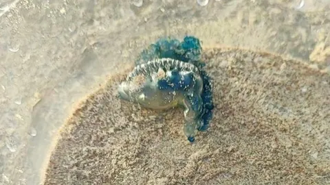 สาวแชร์อุทาหรณ์ สามีสัมผัสโดน "แมงกะพรุนไฟหมวกโปรตุเกส" จนเป็นแผลแสบร้อน