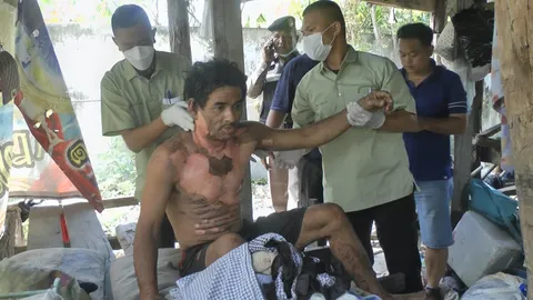 อดีตผัวโหดสาดน้ำมันเผาเมียเก่า แม่ยายสาหัส ตัวเองโดนไฟลวกหนีไม่รอด