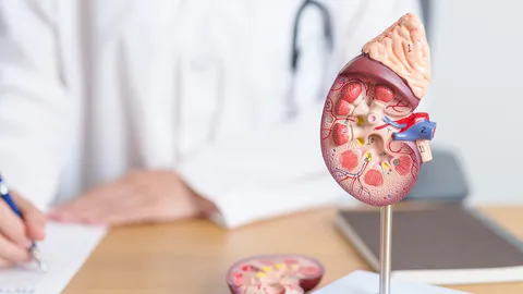 “Cystic kidney disease” ถุงน้ำในไต..ถ่ายทอดได้ทางพันธุกรรม