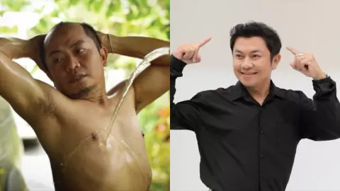 อี๊ด โปงลาง “ถอดหมวก โชว์ทรงผมใหม่ หน้าเด็กกว่าเดิม" หลังขึ้นเขียงปลูกผม ย้อนวัยสมัยยุคโปงลางสะออน