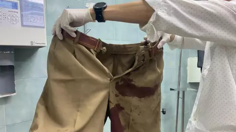 ม.ต้น พกปืน ชักขู่ช่างกล ลั่นโดนอัณฑะตัวเอง บาดเจ็บ