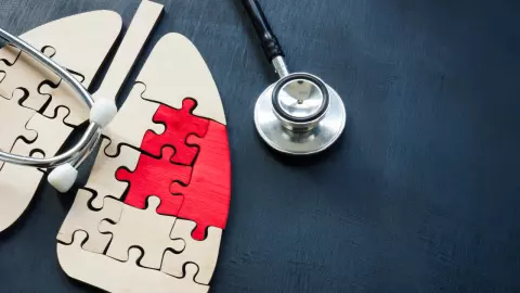 มะเร็งปอด รักษาได้ไหม มีวิธีไหนบ้าง