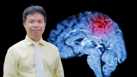 เรื่องจริงจากห้องผ่าตัดเตือนใจนักบิด ไม่อยากเจอกะโหลกแตกเลือดคั่ง ทำยังไงดี