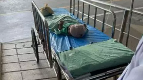 สยอง ฝูงลิงบุกบ้านกัดหัวเด็ก 3 เดือนที่กำลังดูดนม เขี้ยวเจาะถึงกะโหลก