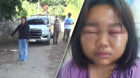 แม่แจ้งความ เพื่อนรุ่นพี่นัดลูกสาววัย 13 ไปเคลียร์ รุมตบหน้าตาปูด