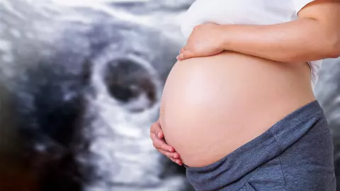 สาวมดลูกแฝดใกล้คลอด