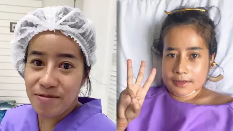 เปิดหน้า หนูรัตน์ สวยขึ้นมาก หลังขึ้นเขียงผ่าตัดแก้ไขหน้าผาก-ขากรรไกร 