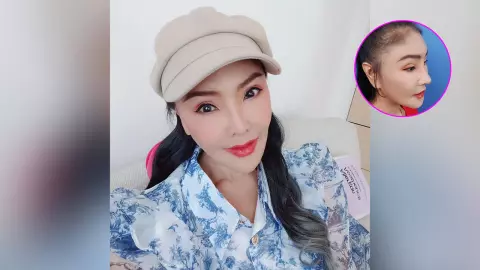 ดาว มยุรี เปิดหน้าหลังทำจมูกใหม่ในรอบ 20 กว่าปี ชาวเน็ตชม สวยปังมาก